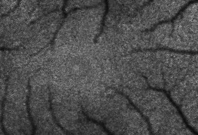 RPE Cells Imaged