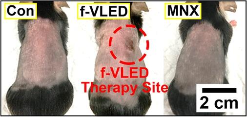A Wearable Device for Regrowing Hair