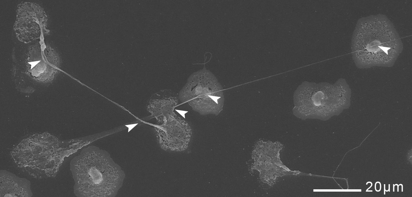 NET-casting Neutrophils
