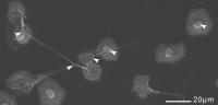 NET-casting Neutrophils
