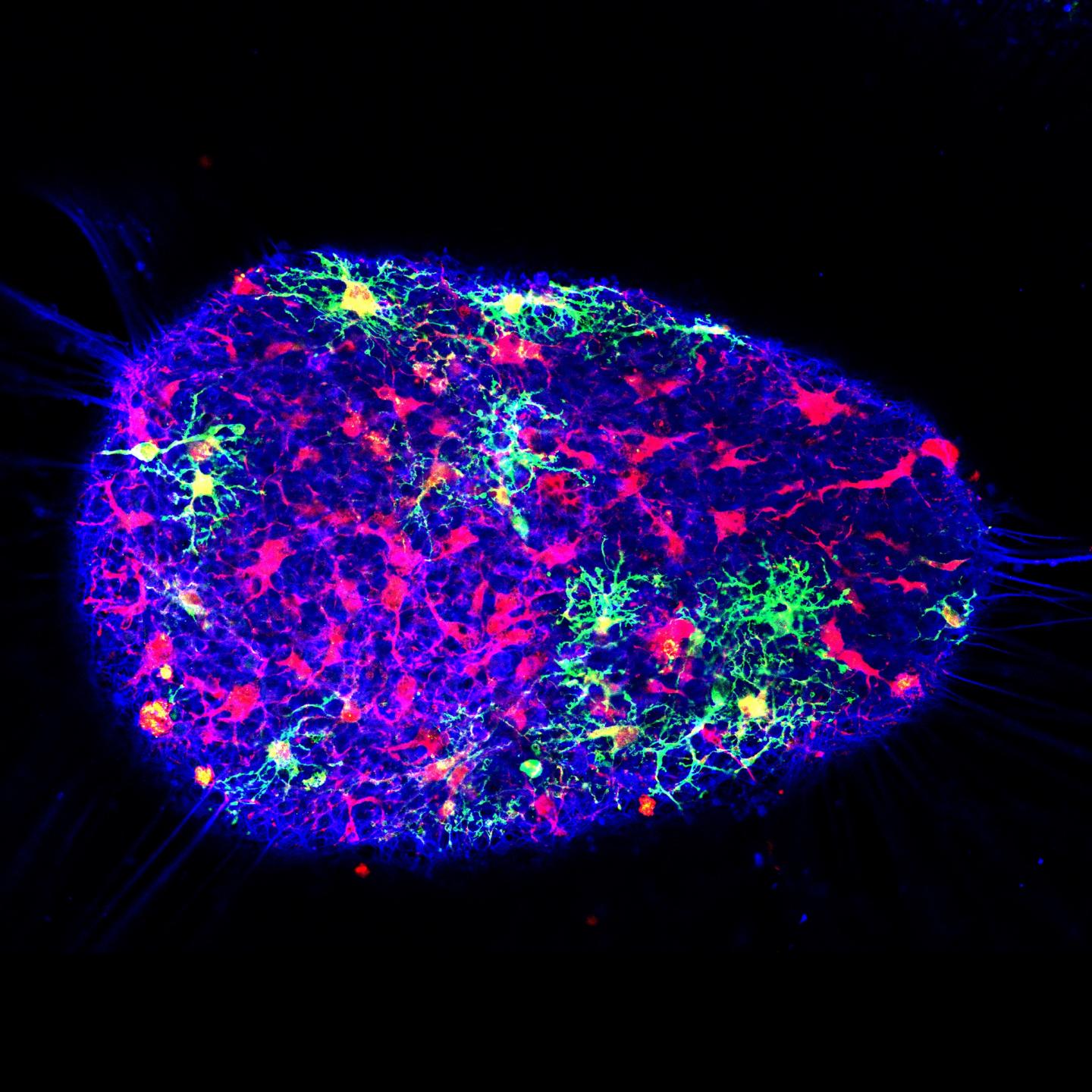 Study Introduces New Bioengineered Mini Brains Called 'Asteroids'