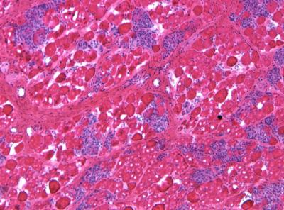 Untreated Dystrophic Dog Muscle