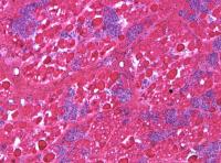 Untreated Dystrophic Dog Muscle