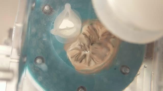 3-D Printed Heart Valve