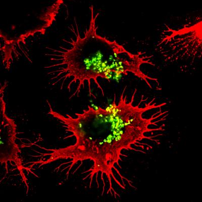 Infected Cell