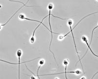 Milestone Reached on Path to New Form of Male Contraception (3/3)