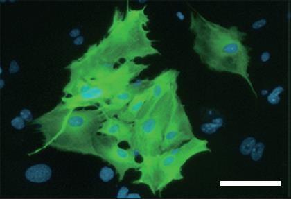 Tbx6 Revealed as Crucial to Heart and Skeleton Formation from Stem Cells