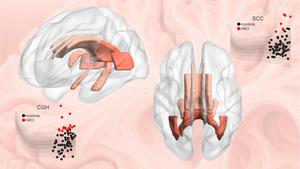 Statistical charts compiled from a large population allow brain abnormalities to be detected in new individuals.