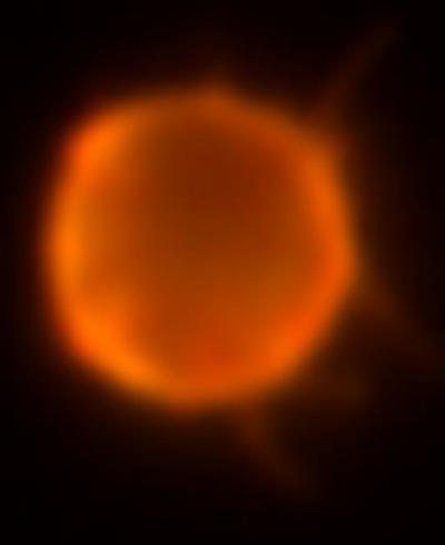 Leukemia Cell Image