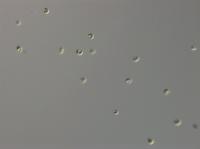 Several Cells of the Prey Species, the Green Alga Monoraphidium minutum
