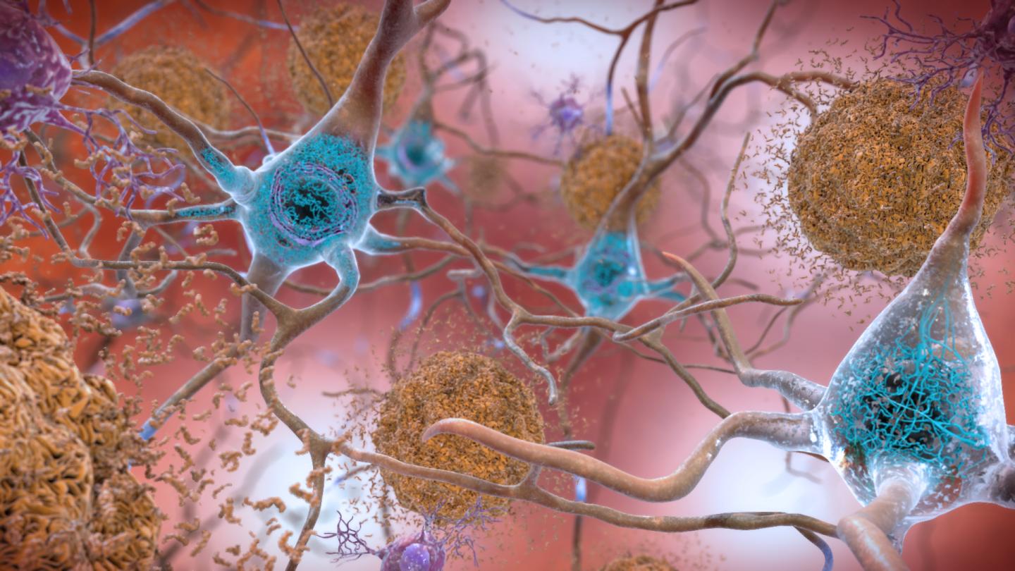 Amyloid Beta and P-tau Illustration NIA NIH