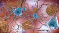 Amyloid Beta and P-tau Illustration NIA NIH