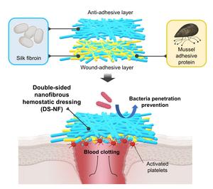 silk fibroin dressing Hypoallergenic Silk Fibroin Surgical Dressing Could Reduce Complications