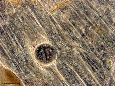 Malaria Oocyst