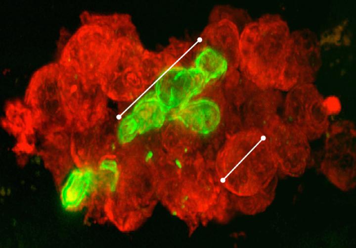 Neutrophils, Attack!