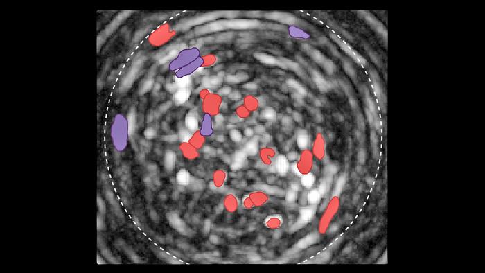 “Brain Dial” for Consumption Found in Mice
