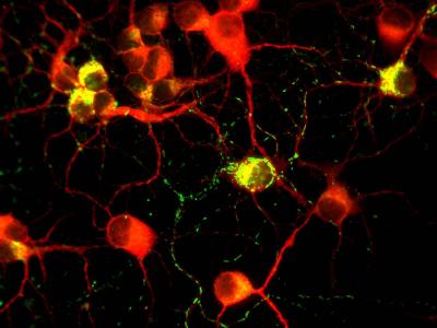 Neurons with the Frataxin Gene Transferred