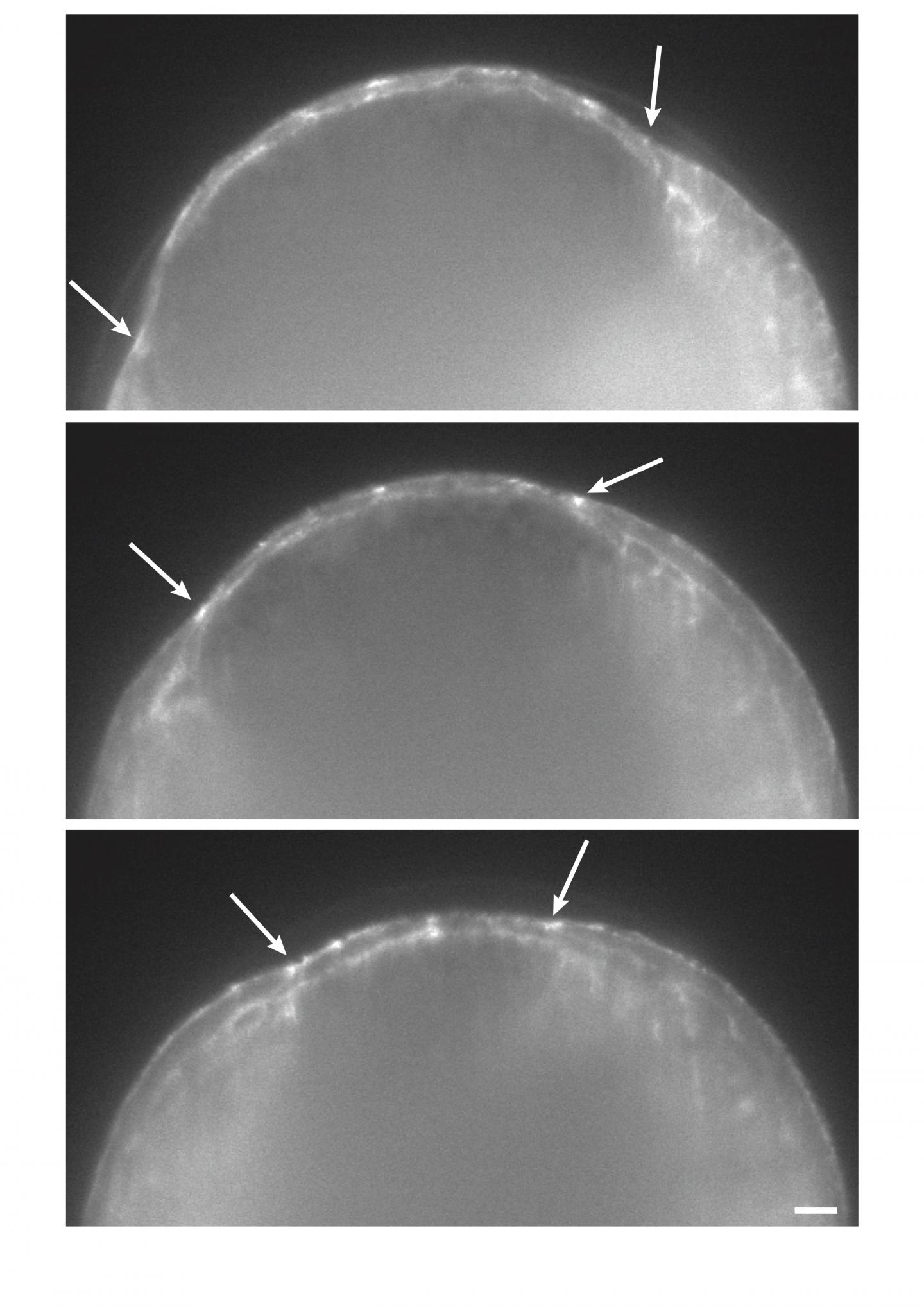 Embryo Expressing Moesin-GFP