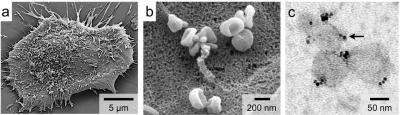 Microvesicles Released by Brain Tumor Cells