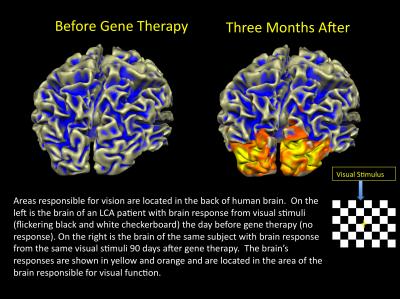 fMRI Shows Cortical Activation