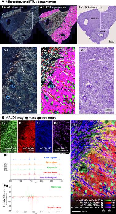 Example of multimodal molecular characterization of human kidney tissue.