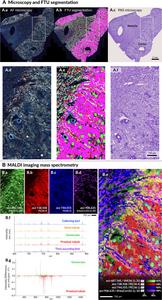 Example of multimodal molecular characterization of human kidney tissue.