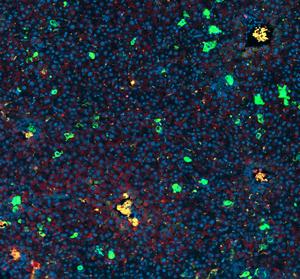 Immunofluorescence image showing GPX4 (red cells), NRAS (green cells) and NRAS/GPX4 (yellow cells) in mouse.