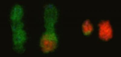 Translocations of Chromosomes 11 and 13