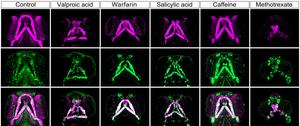 Craniofacial anomalies in zebrafish.