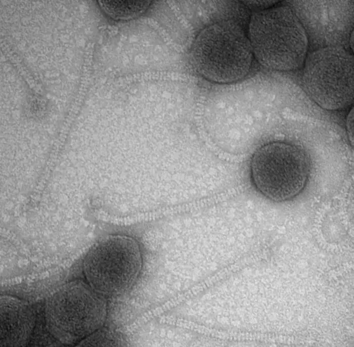 Phages - electron micrograph image 2