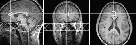 Effects on the Brain