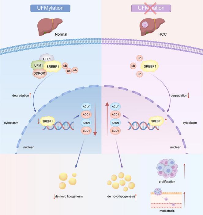 DysUFMylation of SREBP1 Promotes the Progression of Hepatocellular Carcinoma by Reprogramming Lipid Metabolism