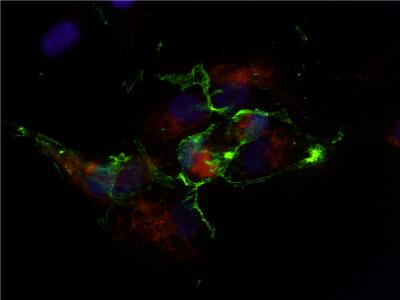 Stem Cell (2 of 2)