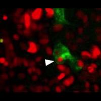 A Senescent Cancer Cell Engulfs and Digests a Neighboring Cell
