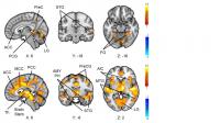 Figure 1: Active Brain Regions