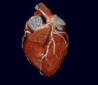 Heart Slice