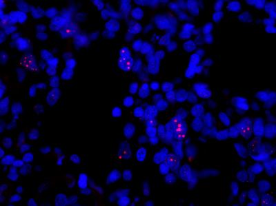 Telomere