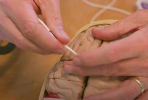Brain shunt tubing demonstration