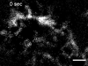 Formation, translation, and contraction of actin filament (Alexa488) rings on membrane tethered His6-curly