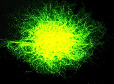 Nerve Cell Axons
