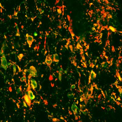 Selective Activation of LC Neurons