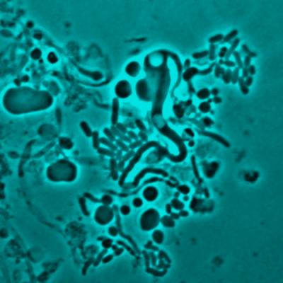 E-coli L-form Switching