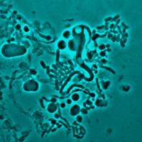 E-coli L-form Switching