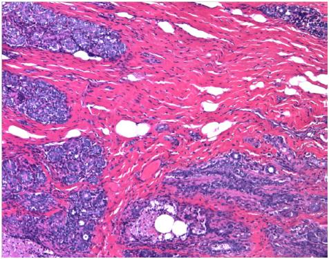 New Breast Cancer Classification Based on Epigenetics