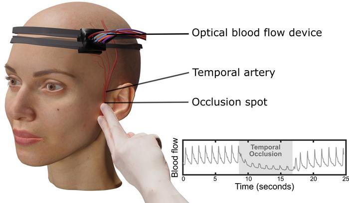 Setup of the laser speckle contrast optical spectroscopy system used to monitor scalp and brain blood flow