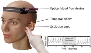 Setup of the laser speckle contrast optical spectroscopy system used to monitor scalp and brain blood flow