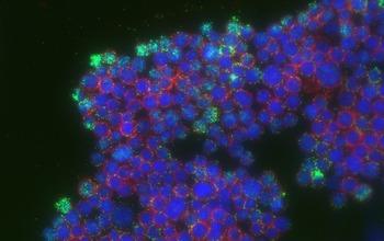 Colon Cancer Cells
