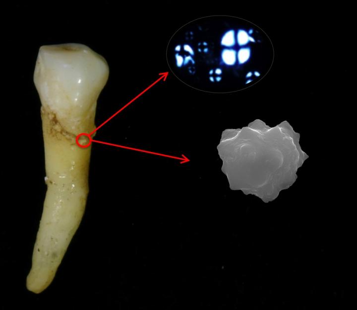Prehistoric Easter Island Diet Clues Provided by Plant Microfossils in Plaque