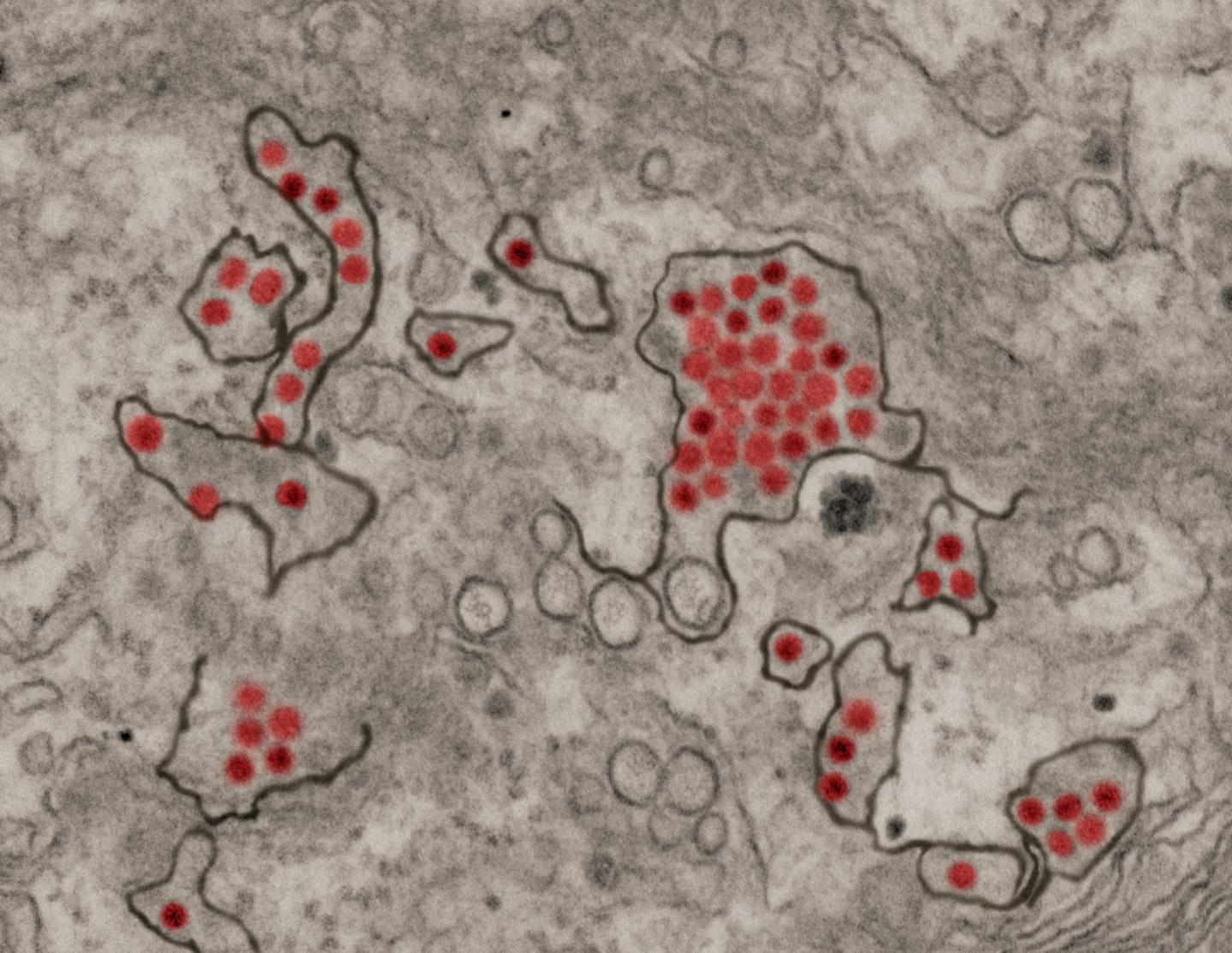 Living Systematic Review Describes the Epidemiology of Sexual Transmission of Zika Virus