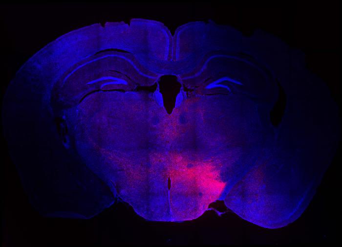 Stress-sensitive hypothalamic neurons are labelled with fluorescent protein to reveal brain-wide arborisations